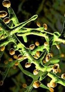 A fungus under a microscope