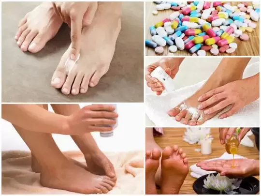 ways to treat fungus between your toes